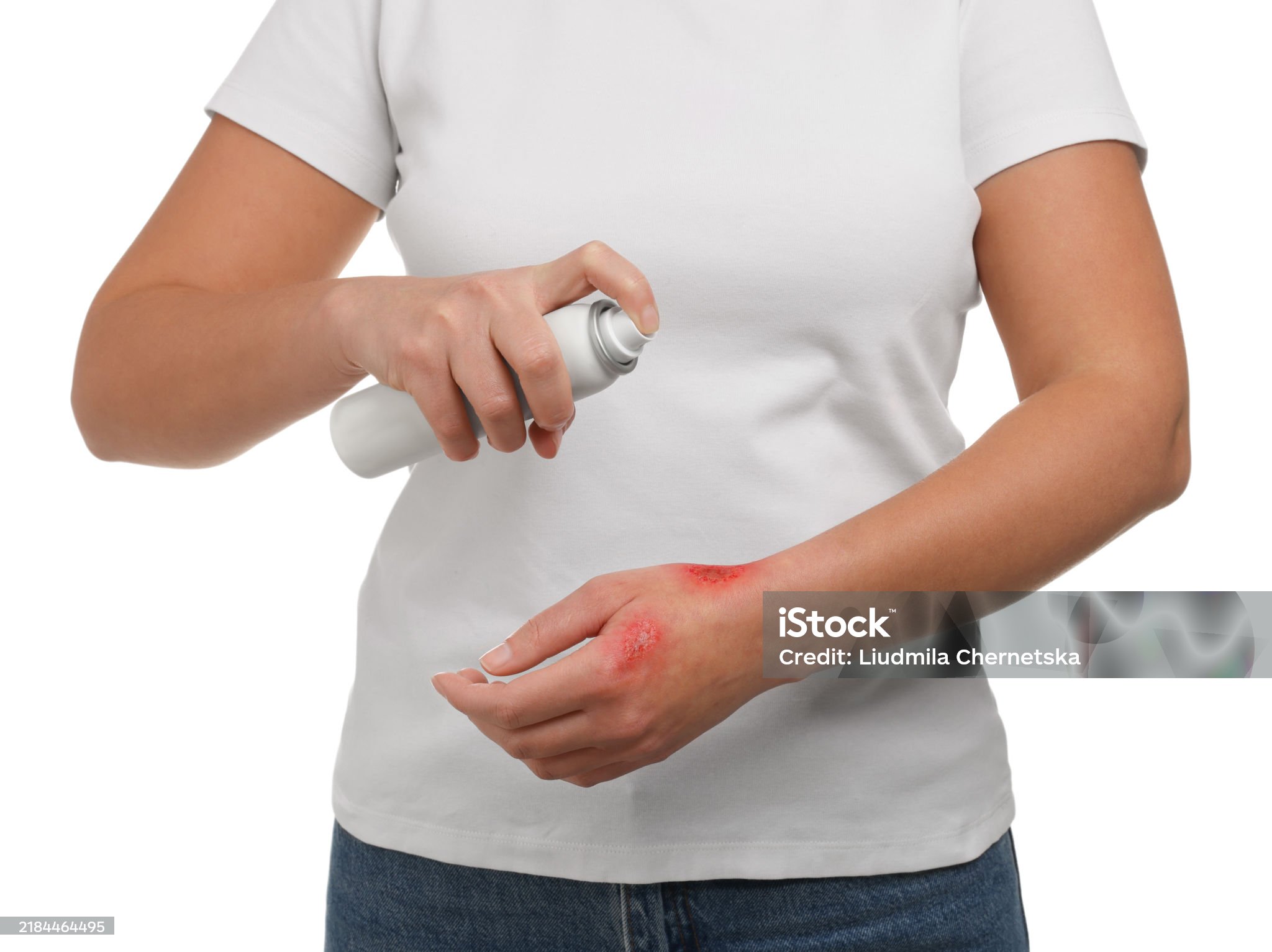 곰팡이 관련 사진