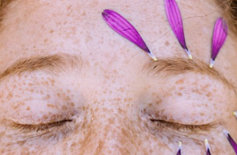 바세린 얼굴에바르는법 및 부작용 1