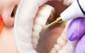 스케일링 이미지/출처:어도비스톡