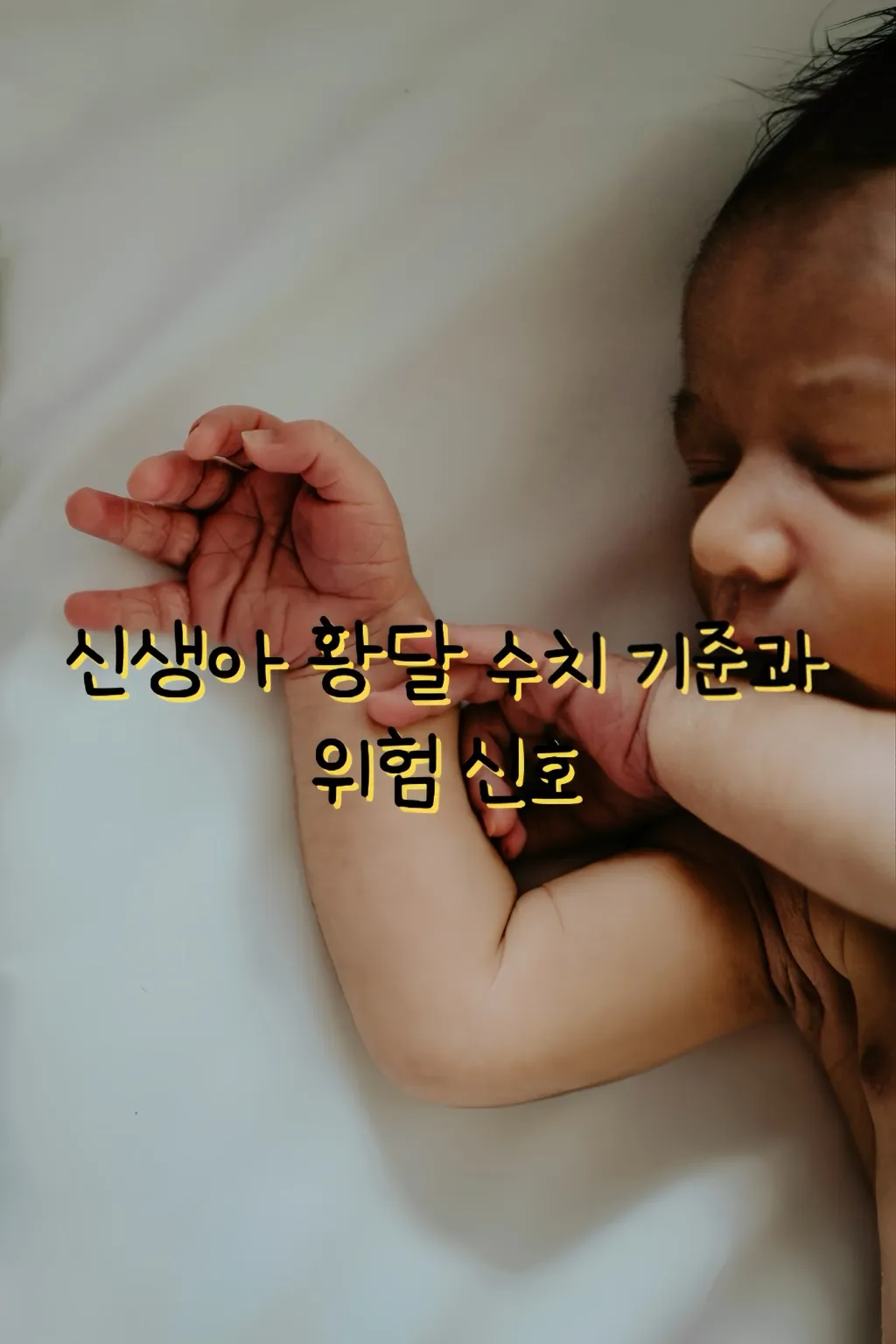 신생아 황달, 황달 수치, 초보맘 이미지 썸네일