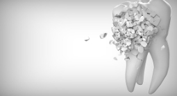 이빨 빠지는 꿈