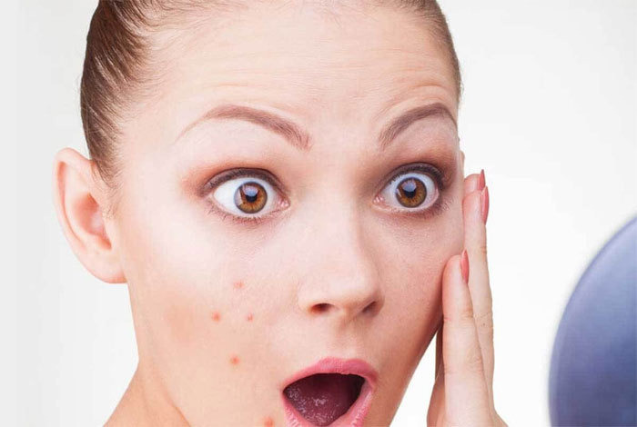 면역력 저하로 나타나는 피부 증상들