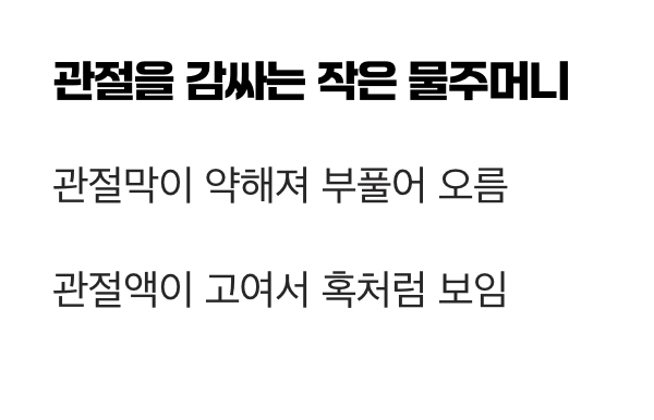 '물혹'의 정체, 관절을 감싸는 주머니