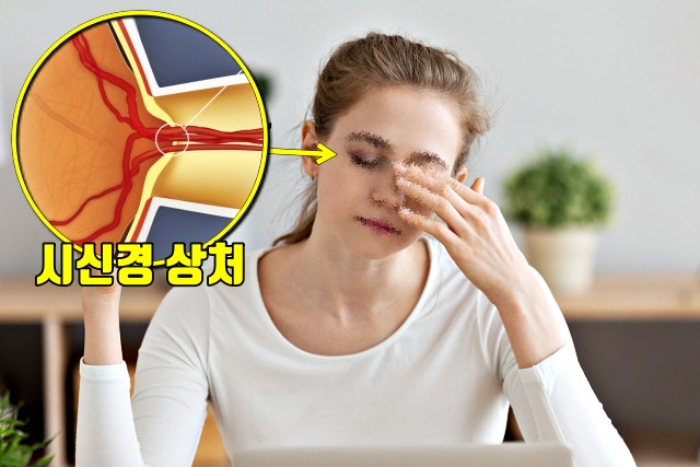 혈압이 높을때 증상, 고혈압 증상, 눈이 흐려보이는 증상, 눈이 침침