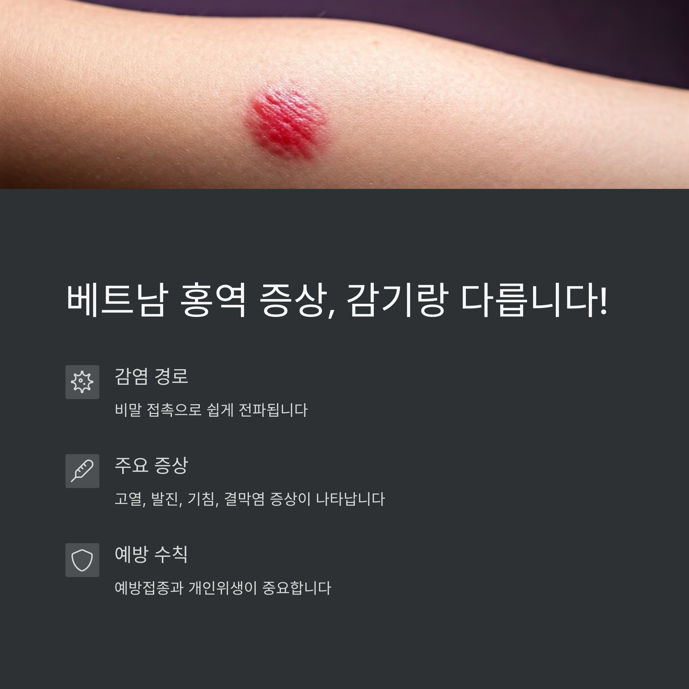 베트남 홍역 증상