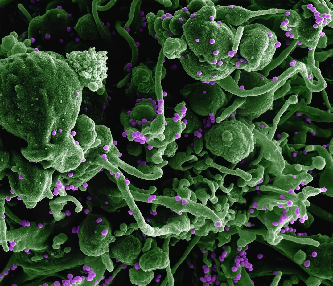 Hemorrhagic.