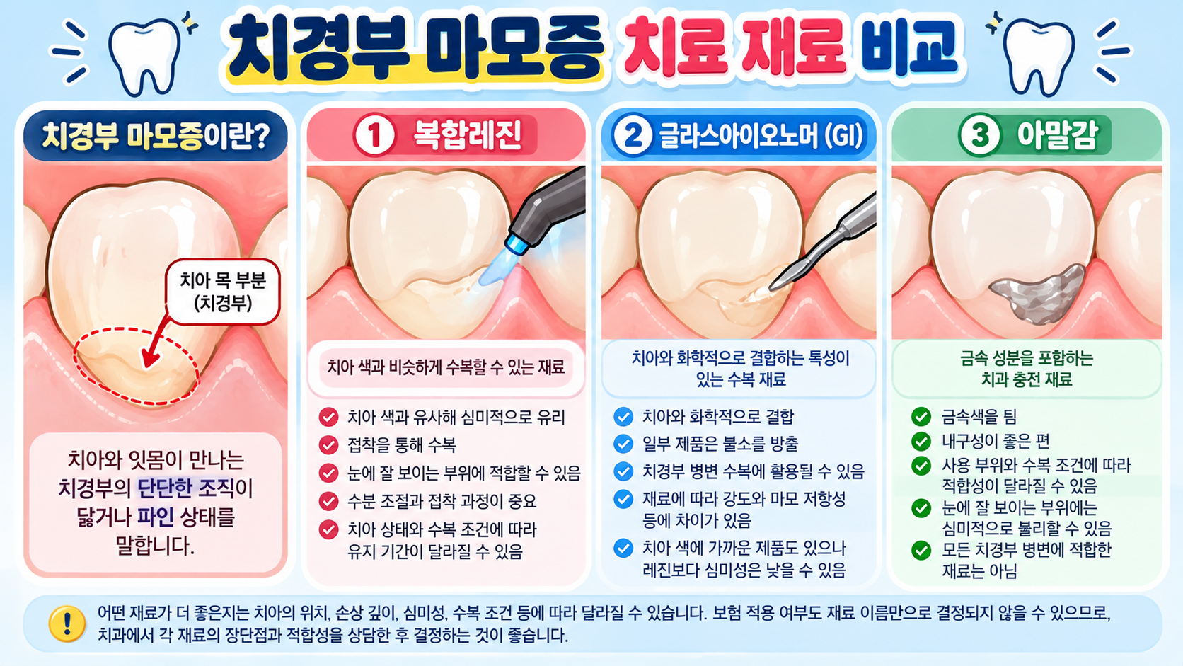 치경부 마모증 치료 재료 비교
