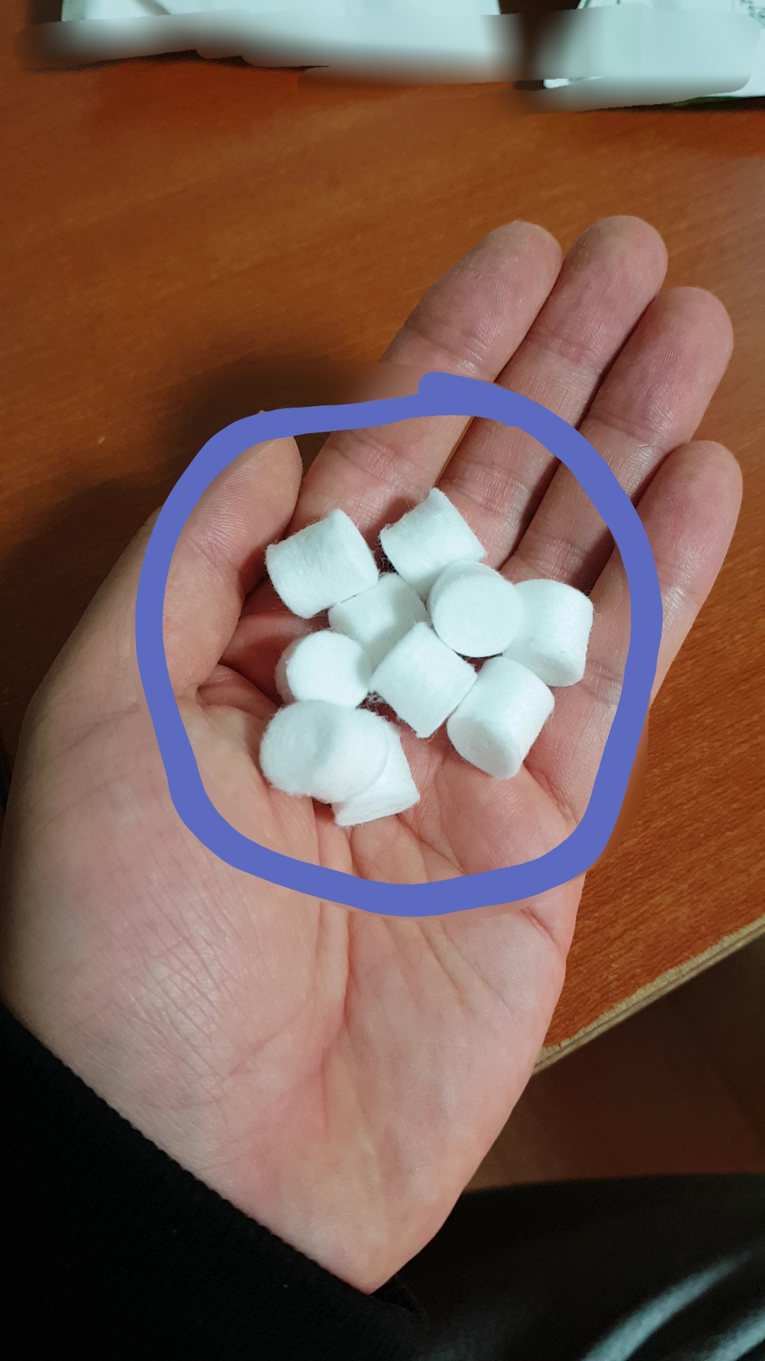비중격 만곡증 수술 후기