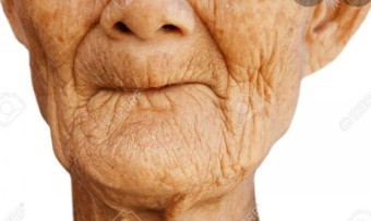 이가-남아있지-않아-입에-주름이-많이진-할머니