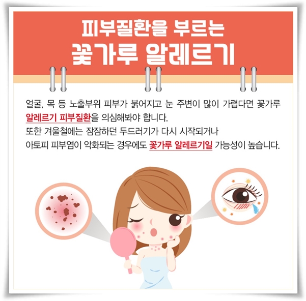 "꽃가루 알레르기" 꽃보다 알레르기로 고생하는 분을 위한 생존 가이드!