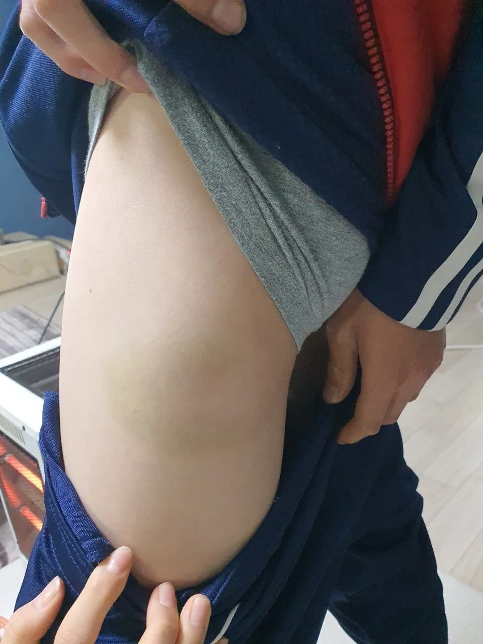 손웅정 감독 아동학대 피해 아동 증거