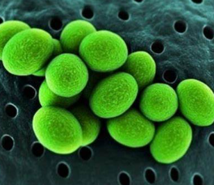 유레아플라즈마 1