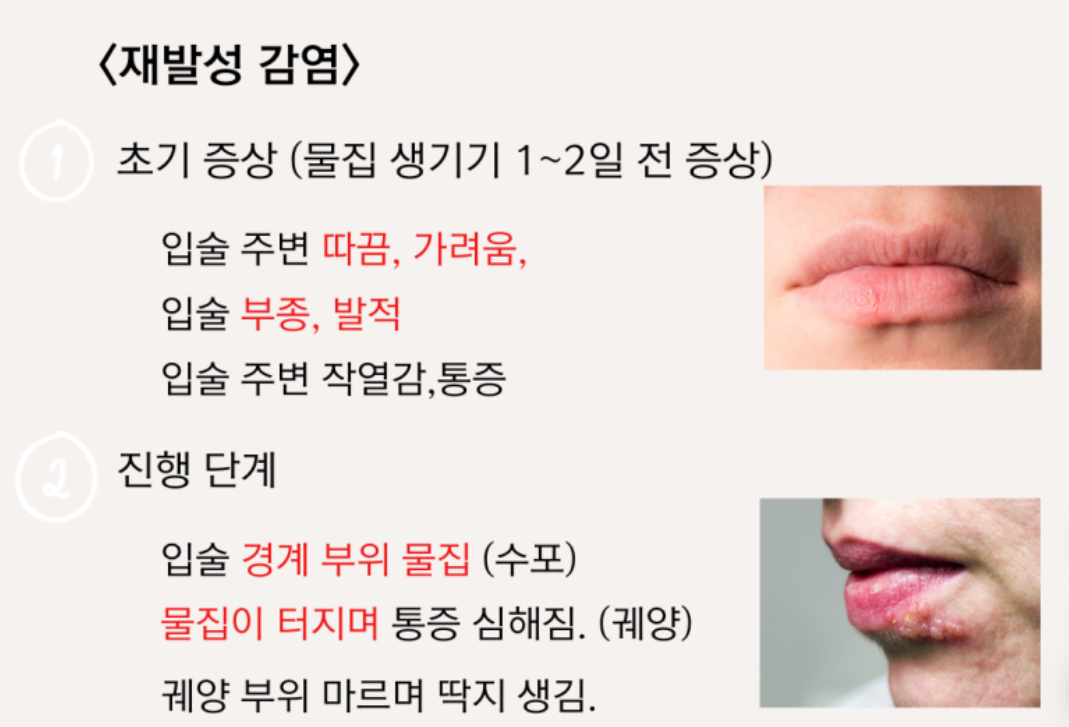 입술 수포