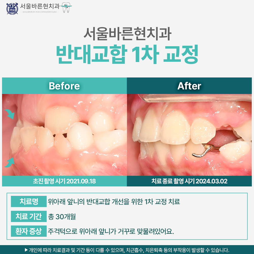 부산교정치과