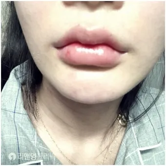 입술 두꺼운 남자 관상 특징과 해석_7
