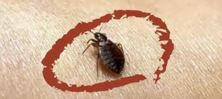 벼룩 물린 자국2