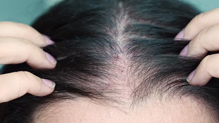 호르몬 불균형과 스트레스