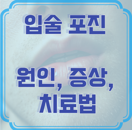 입술 포진 원인, 증상, 치료법 – 재발 막는 관리법까지!