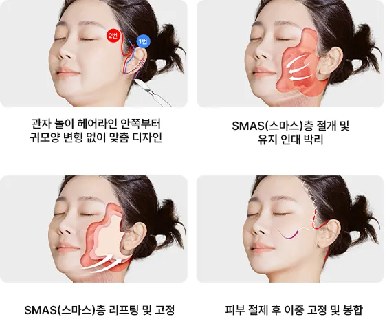 덴서티 리프팅 댄서티 가격 효과 유지기간에 관한 정보_1