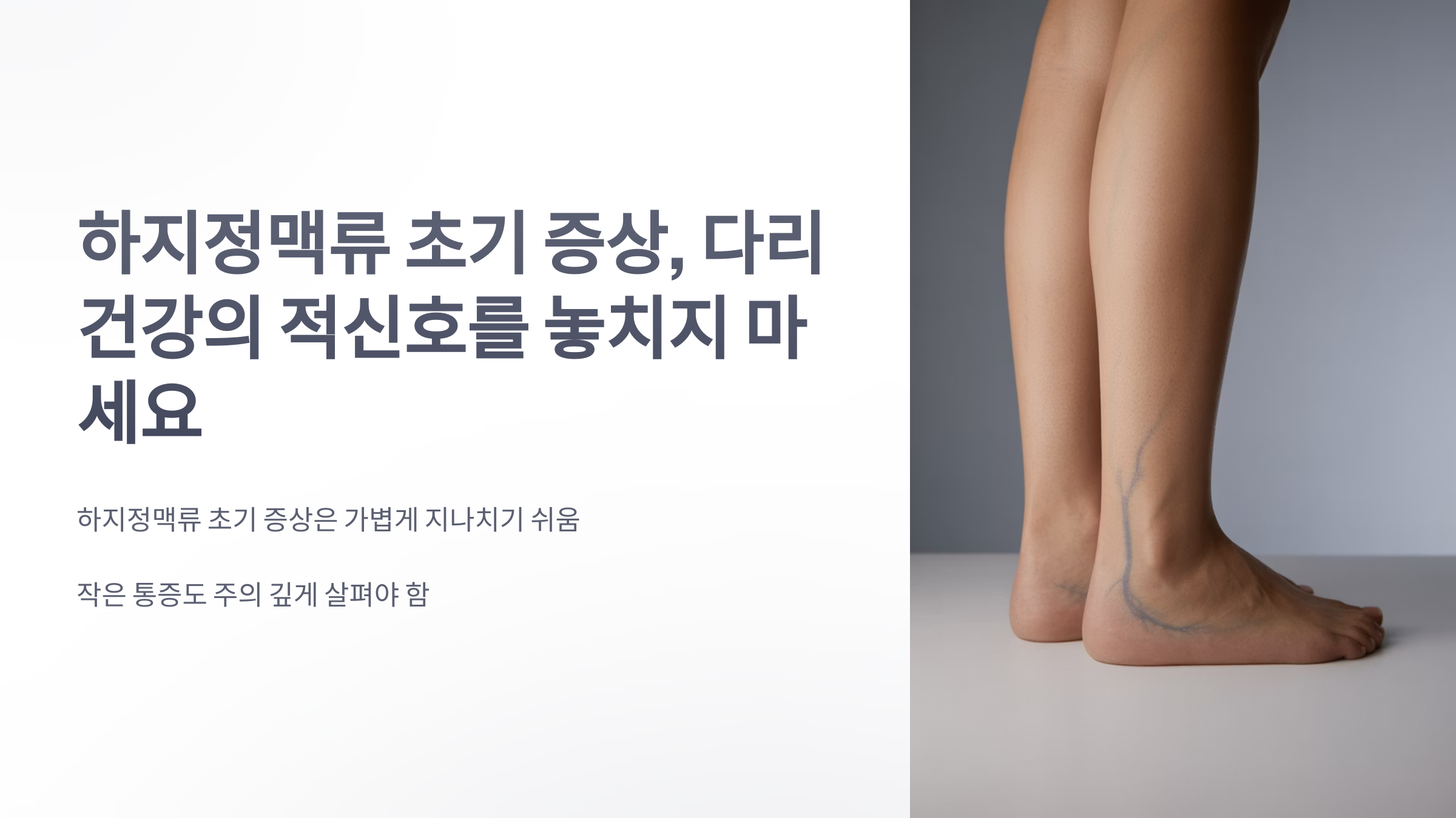 참조-하지정맥류-초기-증상-1