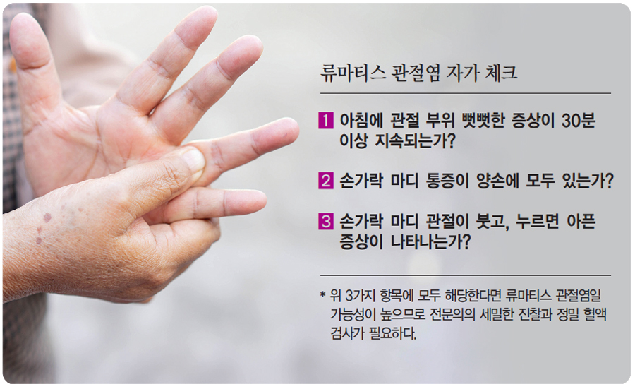 손가락 류마티스 관절염 주요 증상과 체크 리스트