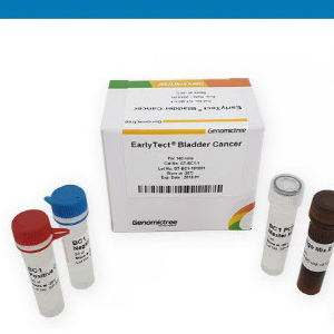 미국 폐렴 진단키트 관련주 대장주 테마주 TOP5