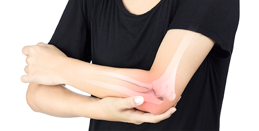 엘보우 운동치료