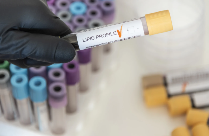 고지혈증 고혈압 원인 및 증상 치료 방법