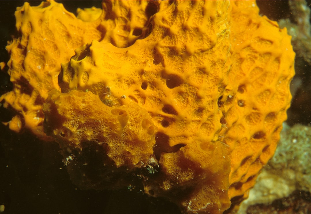 Hematuria