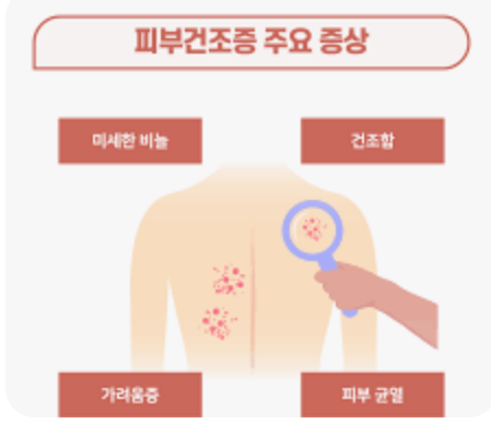 겨울철 피부 건조함과 가려움