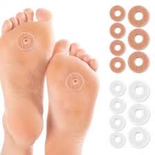 티눈이 생기는 이유