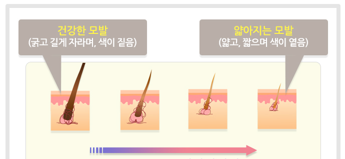 탈모 과정