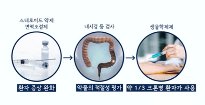 크론병