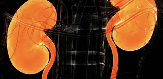 신장암 초기증상 5