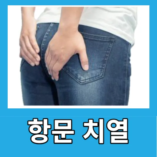 항문 치열