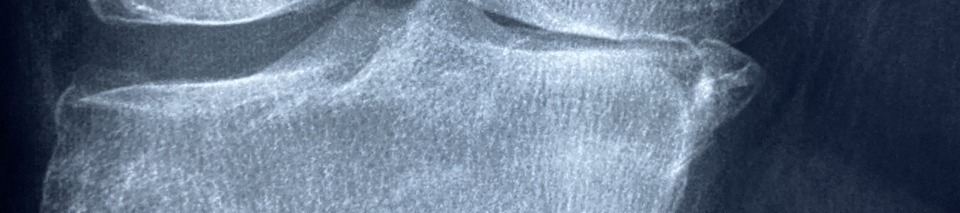 콘드로이친 효능 이미지