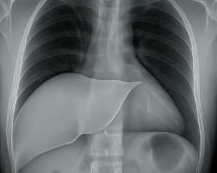 간수치 정상범위