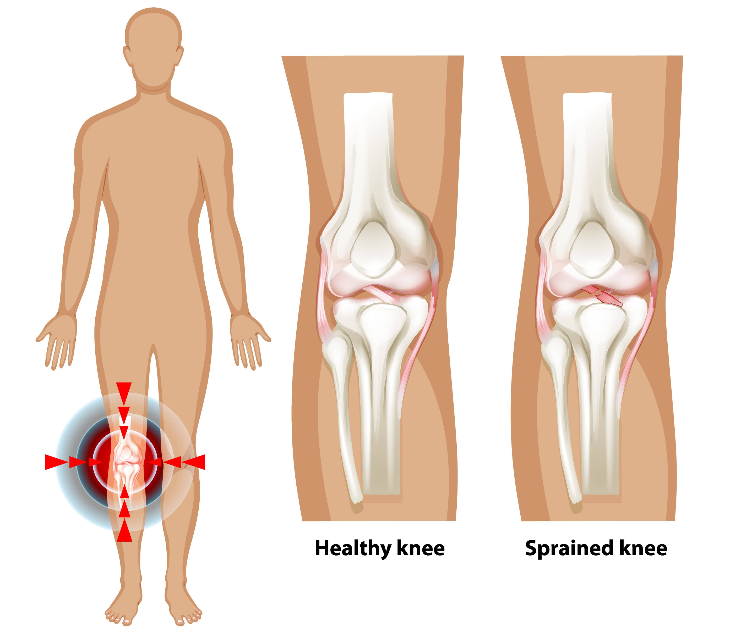 무릎 안쪽 통증 원인