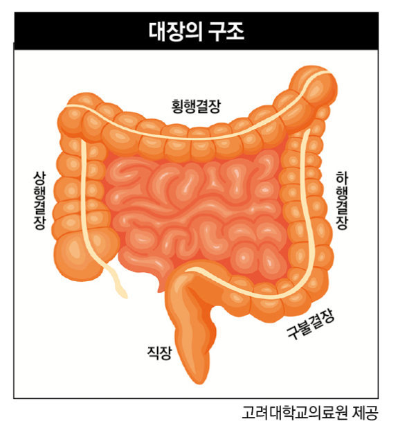 대장암 발병률 세계 1위