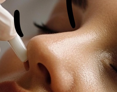 얼굴이 가려운 이유