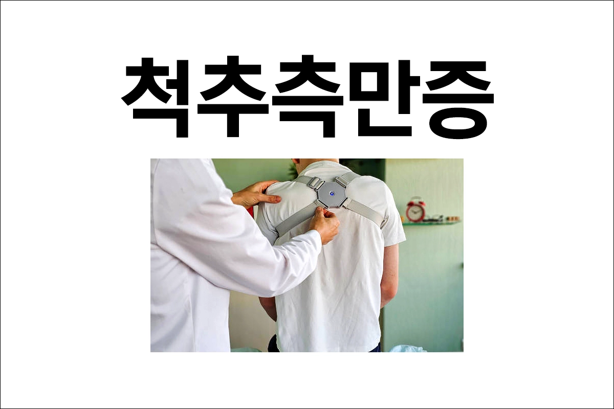 척추측만증 원인 증상 통증 진단 치료 예방