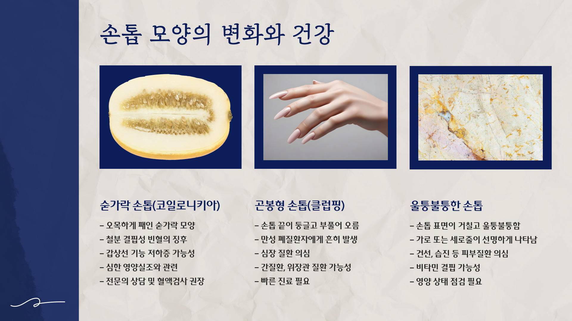 손톱으로 보는 건강상태