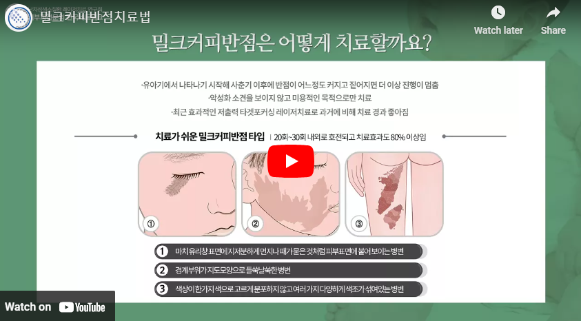 신경섬유종 밀크반점 원인 증상 병원 치료 제거