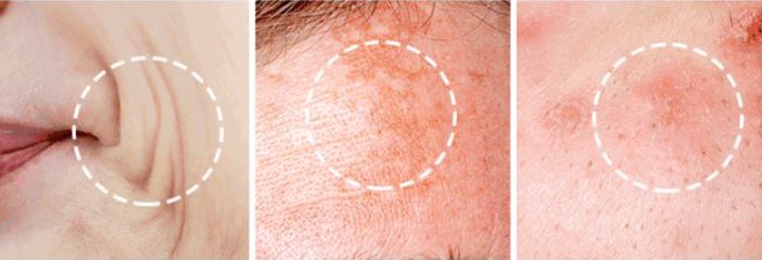 고혼진-화장품-효과