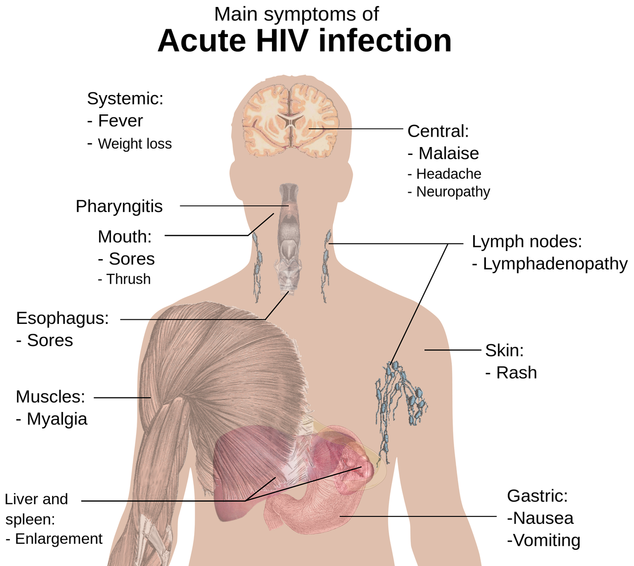식도염 예방 및 치료 모두 알아보기 관련 사진