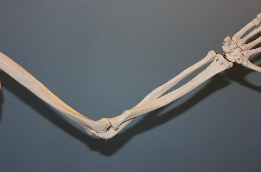 소리 없이 뼈가 죽어가는 병, 급성 골괴사(무혈성 괴사) 완벽 정복: 원인부터 예방까지