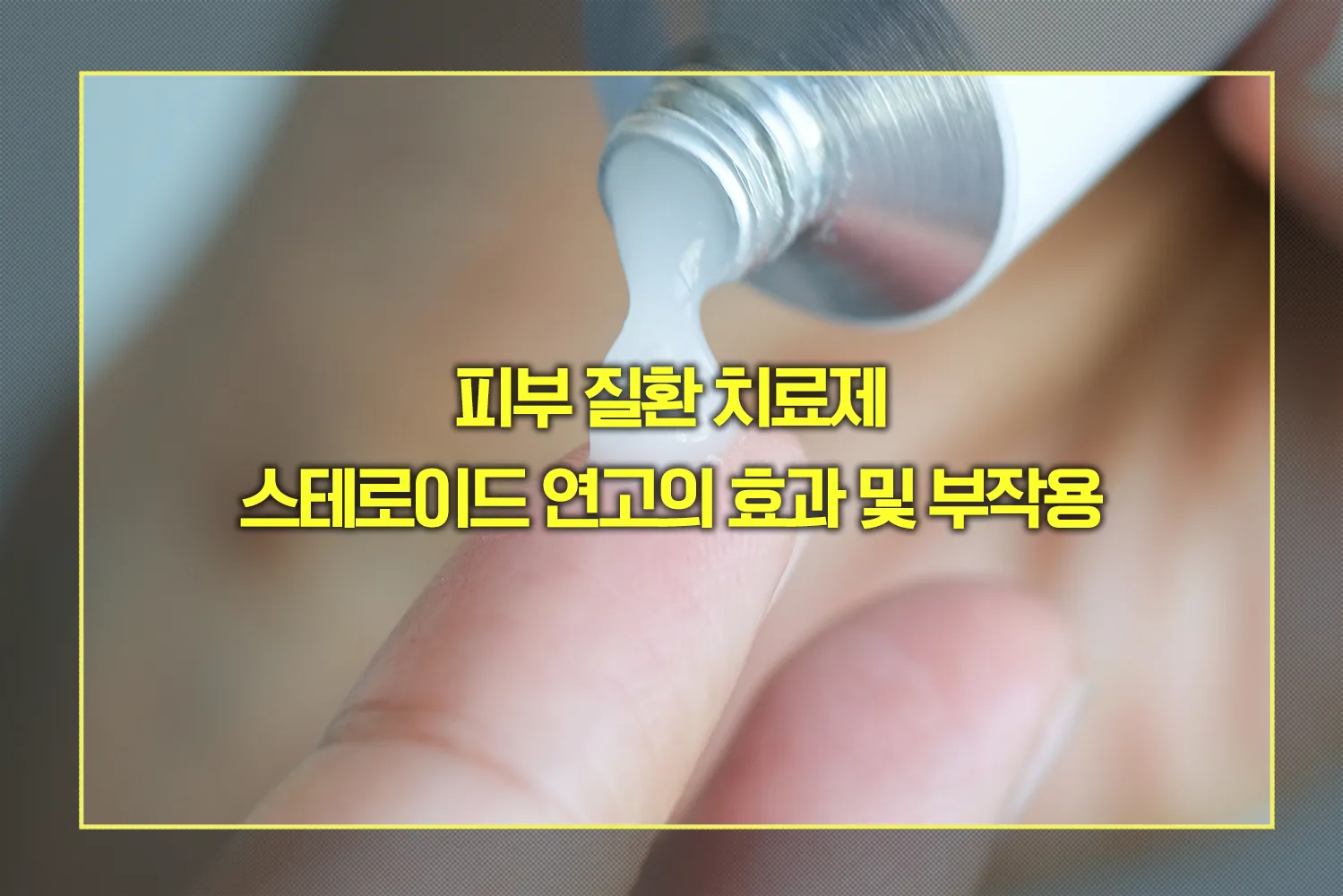 스테로이드 연고 효과, 부작용