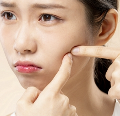 기미없애는방법