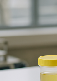 소변 색깔로 보는 건강 &amp;#124; 정상 색&amp;#44; 이상 신호&amp;#44; 병원 방문 기준