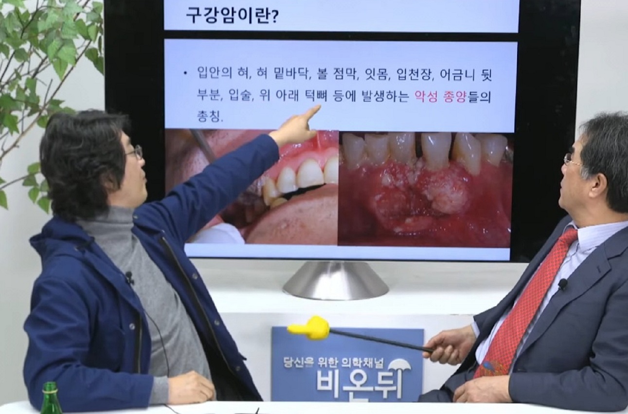 EBS-명의-구강암-이영찬-교수-최승호-교수